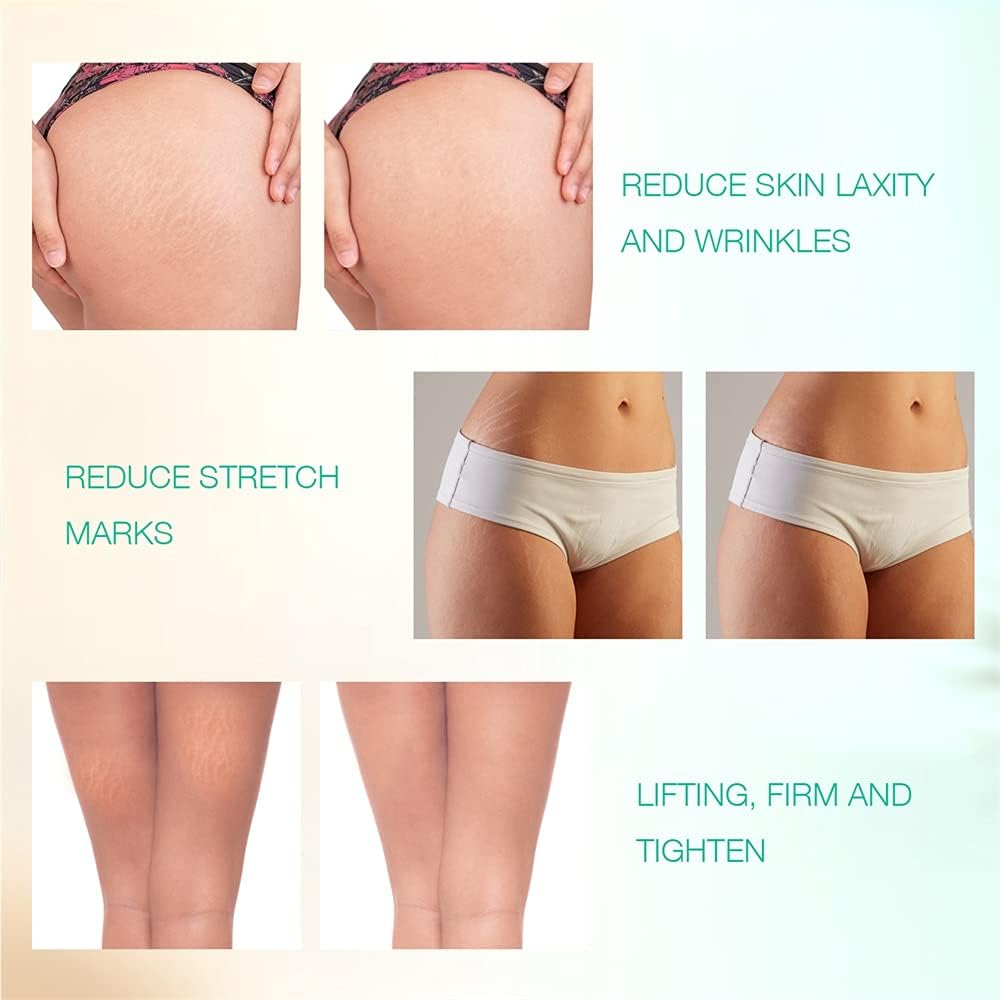 RF Radio Frequency Skin Tightening Device S622